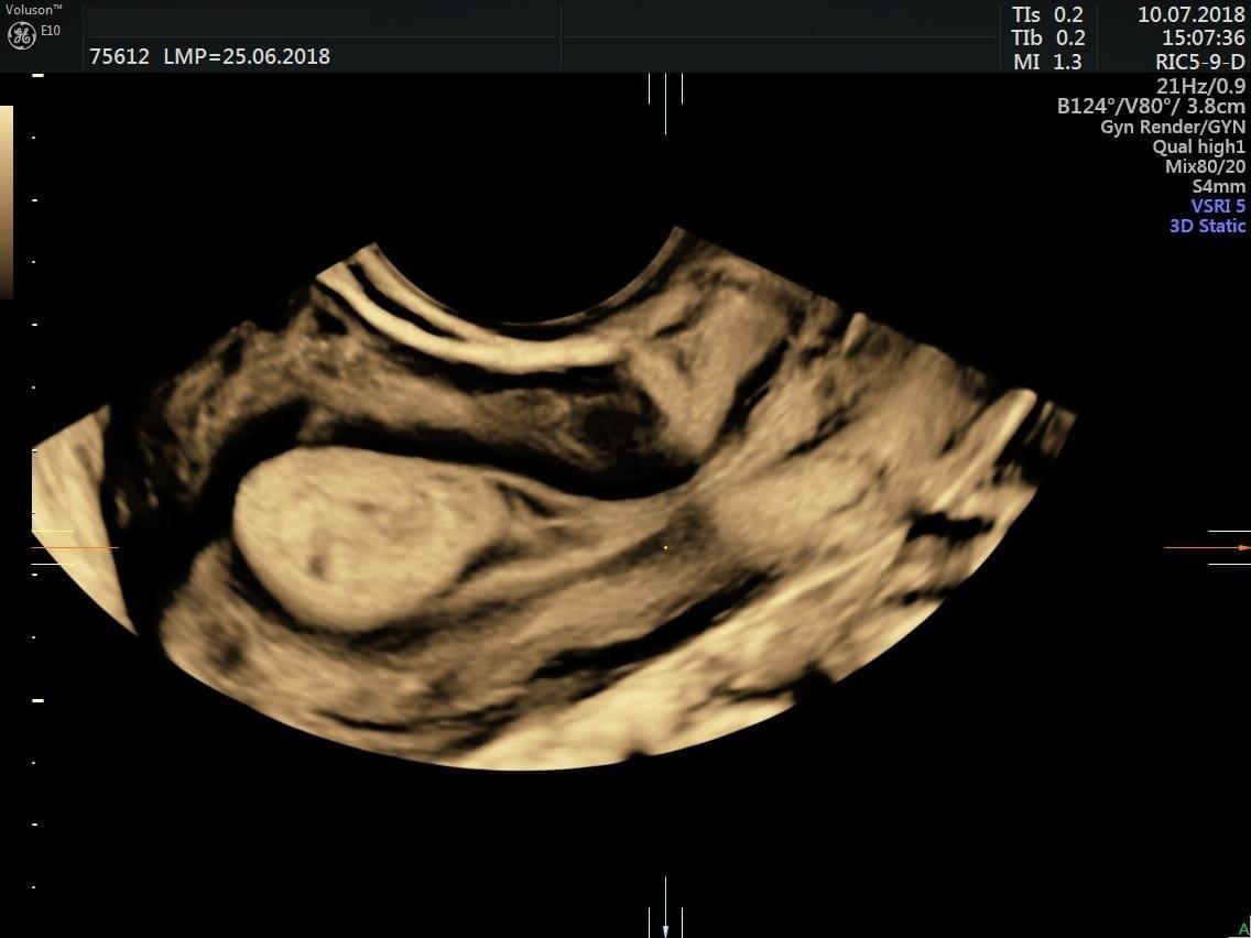 Radiologista Passo Fundo - CEDIL